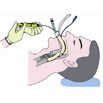 ชุด Tracheostomy แบบใช้แล้วทิ้งทางการแพทย์ที่ผ่านการรับรองจาก CE